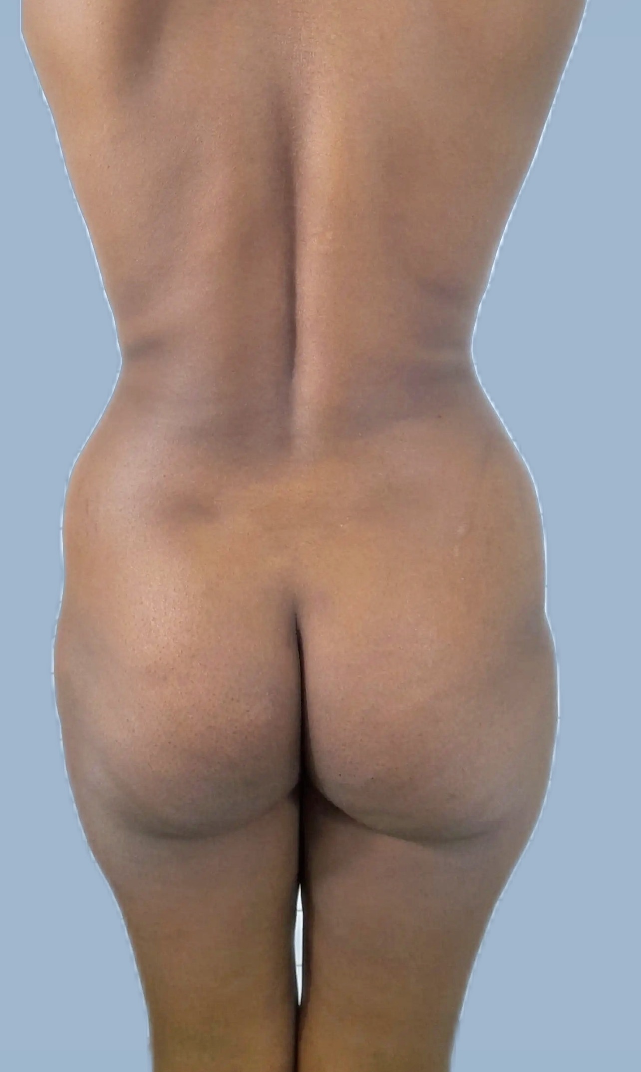Antes - Corporal
